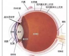 葡萄膜炎——另类致盲“红眼病”